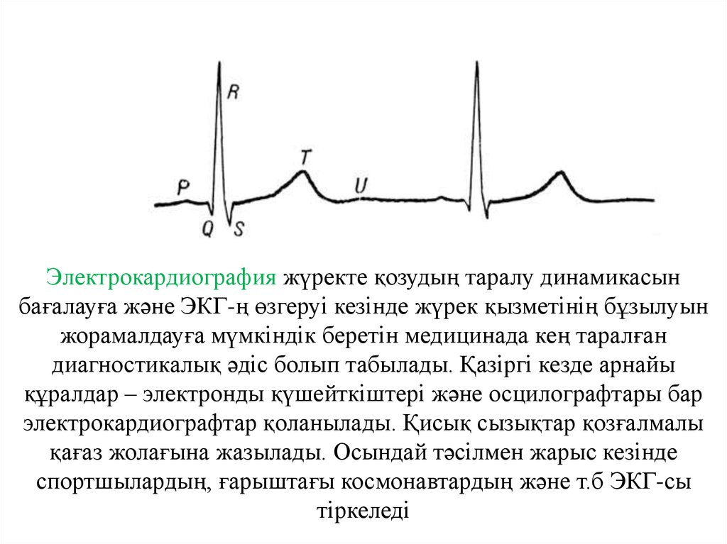 Экг презентация қазақша