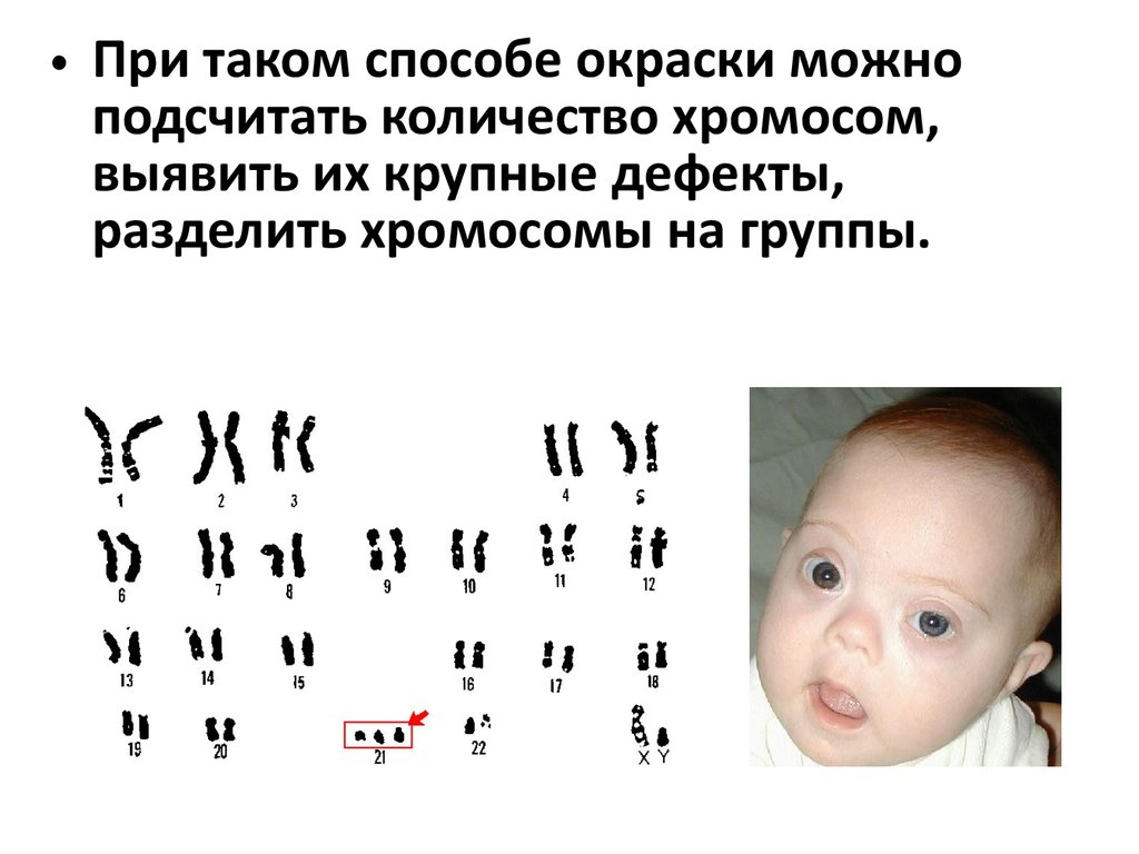 50 chromosome. Хромосомы. Хромосомы человека. 46 Хромосом у человека. 40 Хромосом у человека.