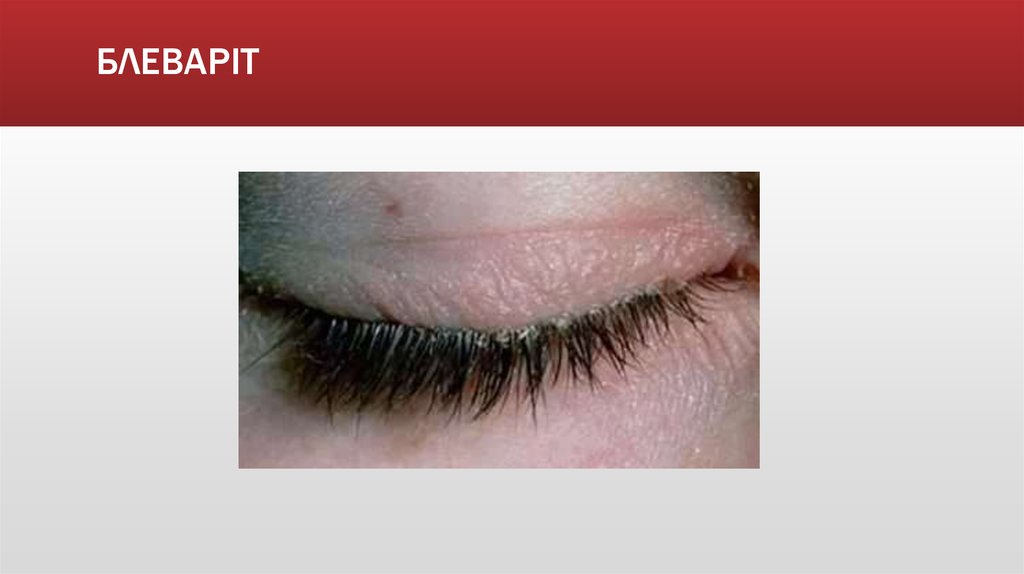 БЛЕВАРІТ