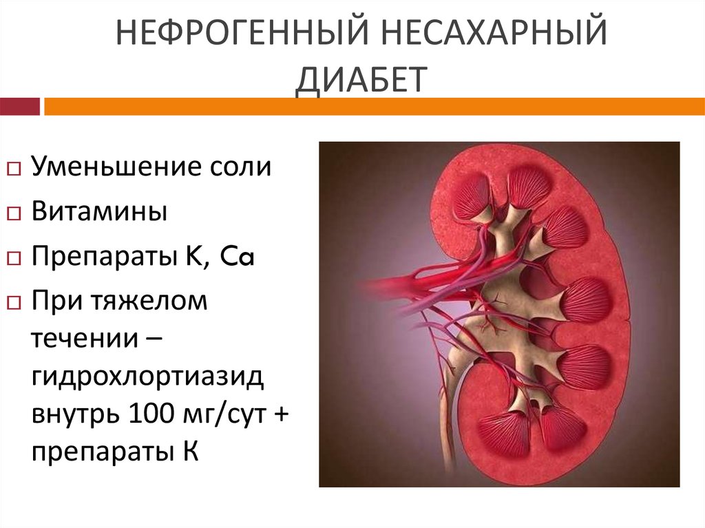 Почечный диабет. Нефрогенная форма несахарного диабета. Почечный несахарный диабет. Патогенез нефрогенного несахарного диабета. Почки при несахарном диабете.