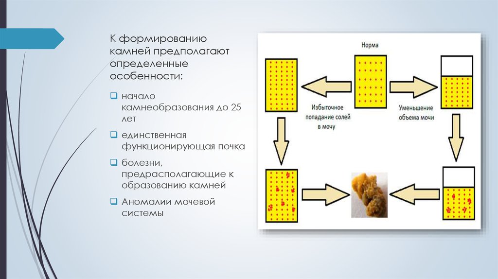 Метод камня. Механизм камнеобразования. Механизм образования камней. Формальный механизм камнеобразования. Особенности процессов камнеобразования.