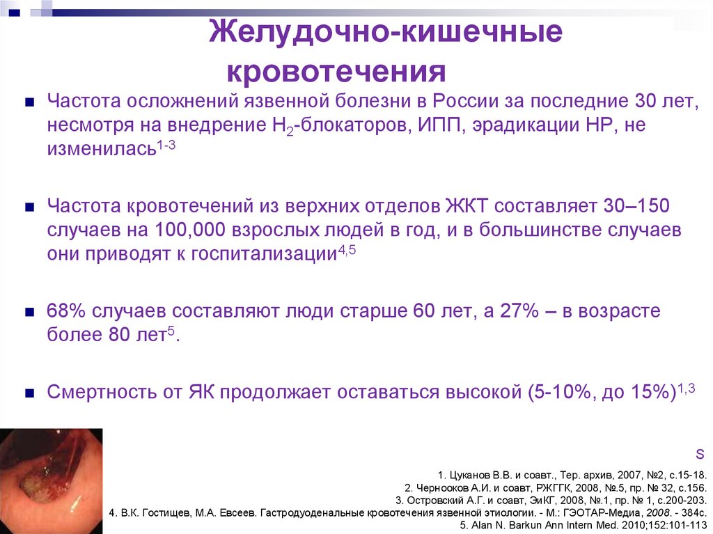 Желудочно кишечные кровотечения язвенной этиологии презентация