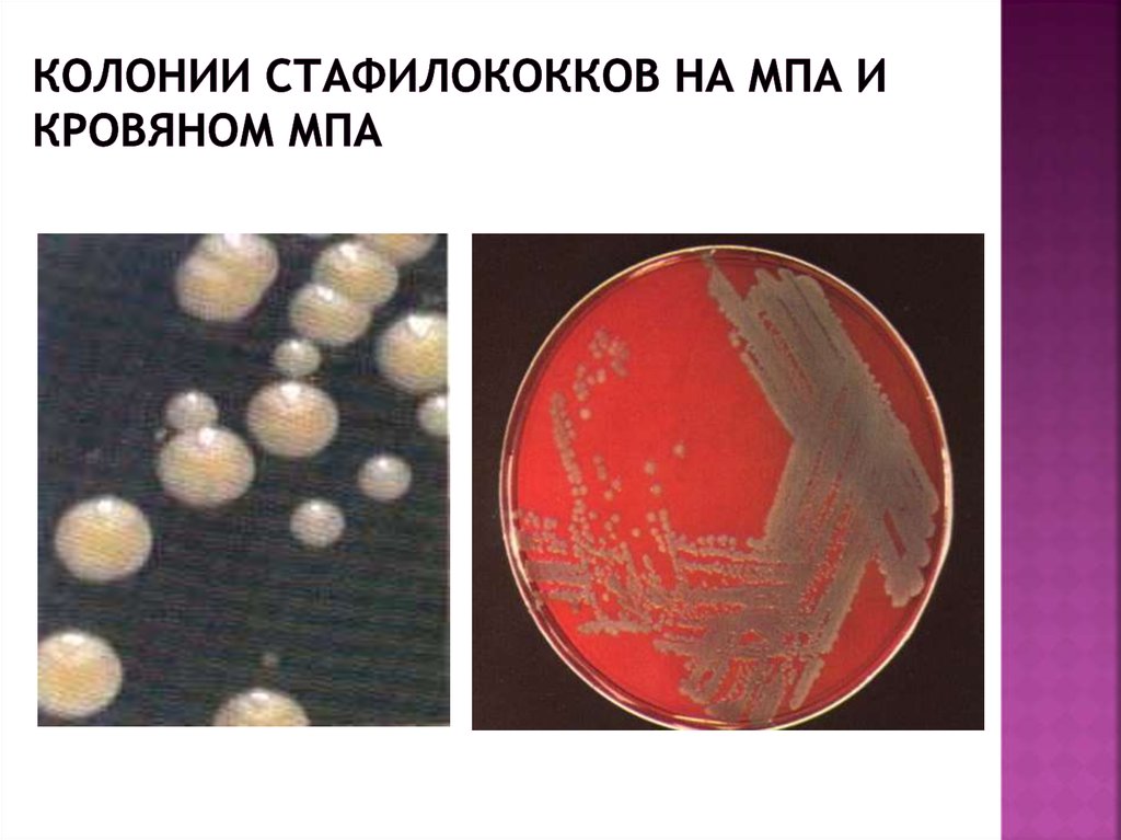 Staphylococcus aureus 3. Колонии стафилококков на МПА. Эпидермальный стафилококк колонии. Колонии стафилококков на кровяном агаре и ЖСА. Колонии стафилококка на ЖСА.