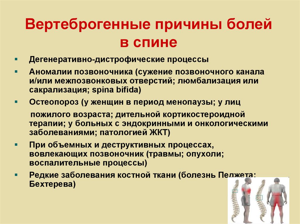 Вертеброгенная люмбалгия