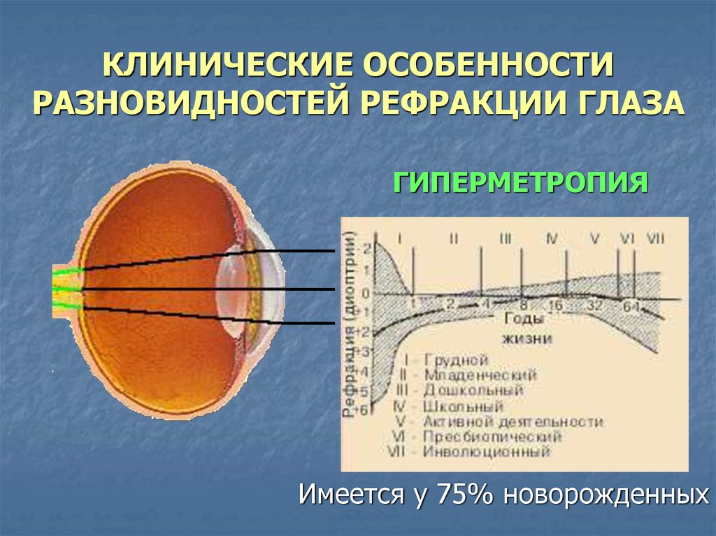 Физ око. Эмметропия миопия гиперметропия. Рефракция глаза. Аномалии рефракции глаза. Рефракция хрусталика.