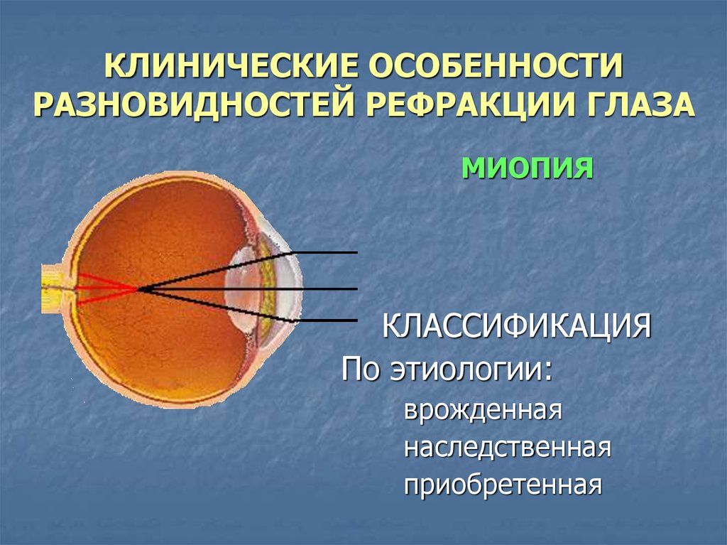 Рефракция глаза презентация