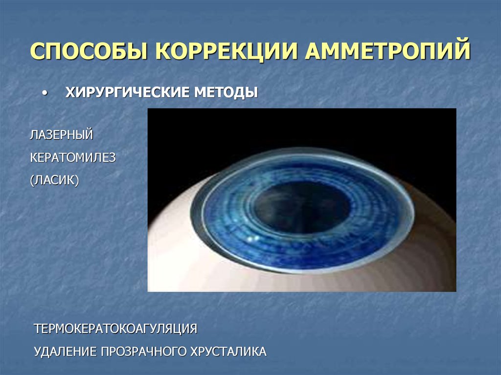 Физиологическая оптика. Способы хирургической коррекции аметропий. Физиологическая оптика глаза. Физиологическая оптика рефракция.