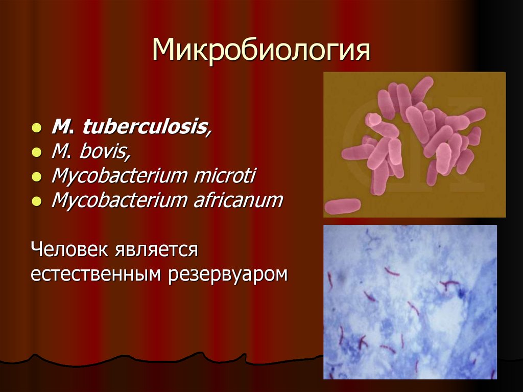 Туберкулез tuberculosis. Микобактериум Бовис. Естественный резервуар туберкулезной микобактерии. M tuberculosis микробиология. Возбудитель туберкулеза микробиология.