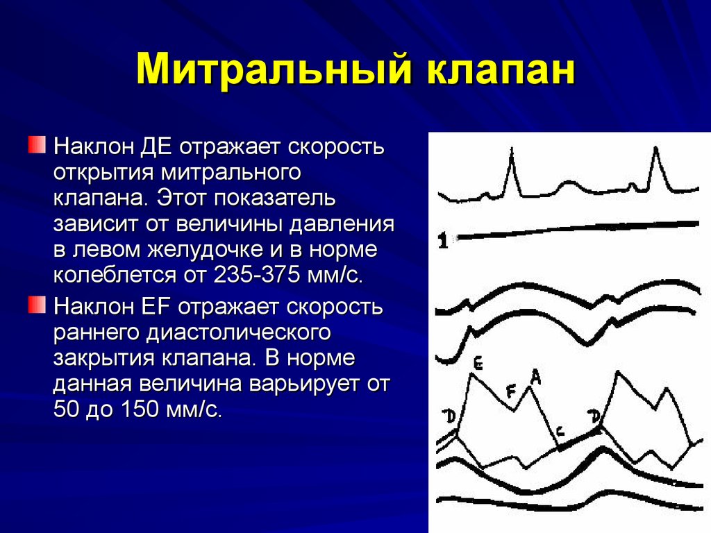 Градиент регургитации митрального клапана