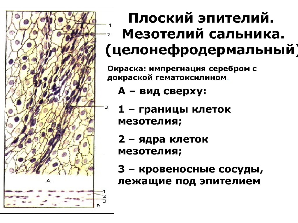 Эпителий плоский. Однослойный плоский эпителий мезотелий гистология. Однослойный плоский эпителий мезотелий сальника. Мезотелий сальника препарат гистология. Однослойный плоский эпителий мезотелий брюшины.