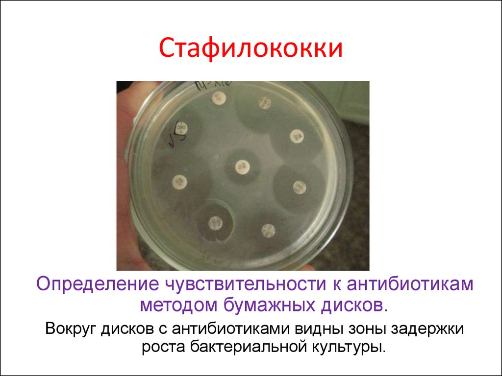 Определение чувствительности. Чувствительность стафилококка к антибиотикам методом дисков. Чувствительность к антибиотикам определяется методом. Чувствительность к антибиотикам стафилококков микробиология. Антибиотики методы определения чувствительности к антибиотикам.