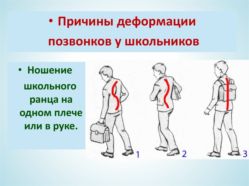Как правильно носить рюкзак