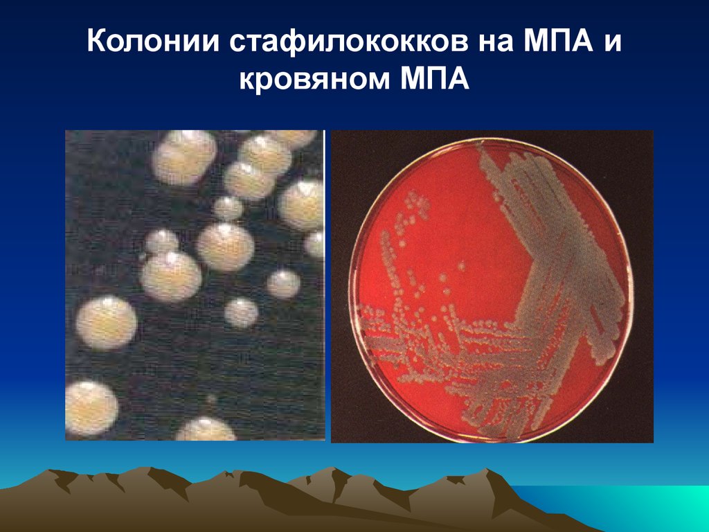 Staphylococcus aureus среда. Колонии стафилококков на МПА. Колонии стафилококка на кровяном агаре. Стафилококкус ауреус на МПА. Колонии стафилококков на ЖСА.