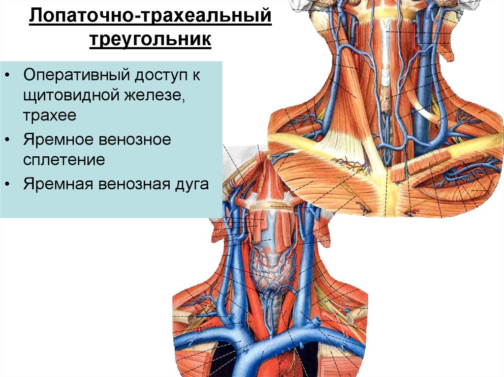 Передняя яремная вена. Внутренняя яремная Вена анатомия кт. Лопаточно трахеальный треугольник шеи. Лопаточной трохальные треугольник. Передняя яремная Вена анатомия схема.