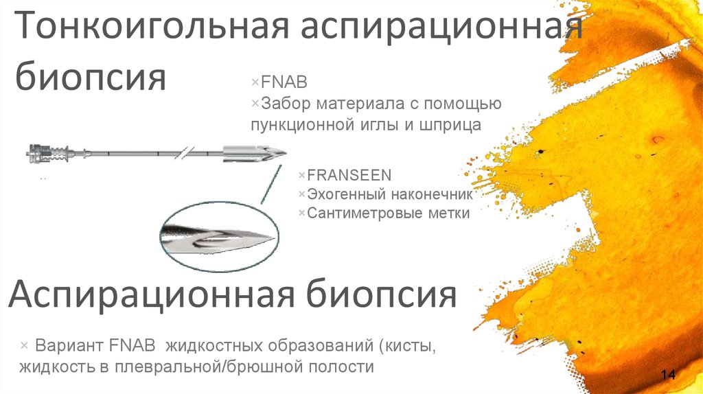 Аспирационная биопсия. Тонкоигольная аспирационная биопсия. Аспирайионна ятонкотглная биопися. Тонкоигольная чрескожная биопсия.