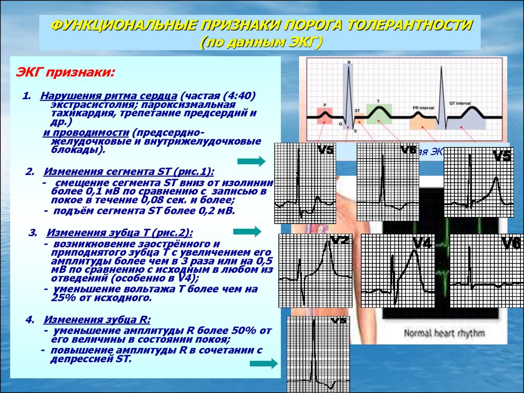 План описания экг