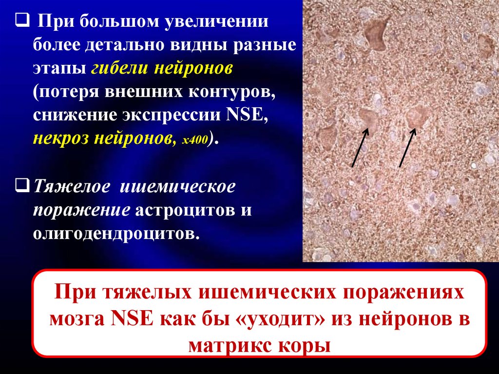 Более увеличенные. Селективный некроз нейронов. Селективный нейрональный некроз. Фаза гибели.