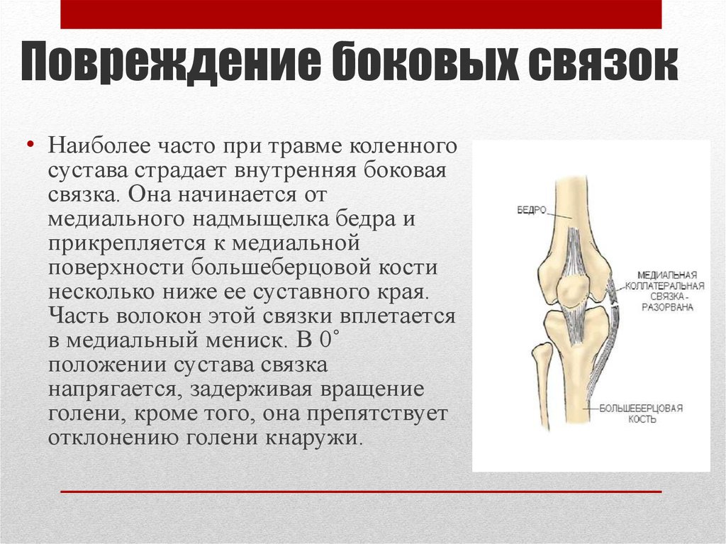 Растяжение коленного сустава карта вызова