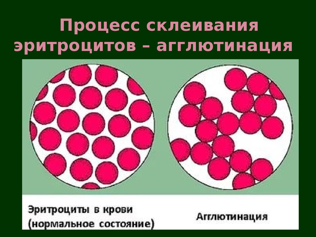 Группа крови клетки. Реакция агглютинации эритроцитов. Переливание крови агглютинация. Реакция агглютинации эритроцитов крови. Агглютинация эритроцитов это процесс.