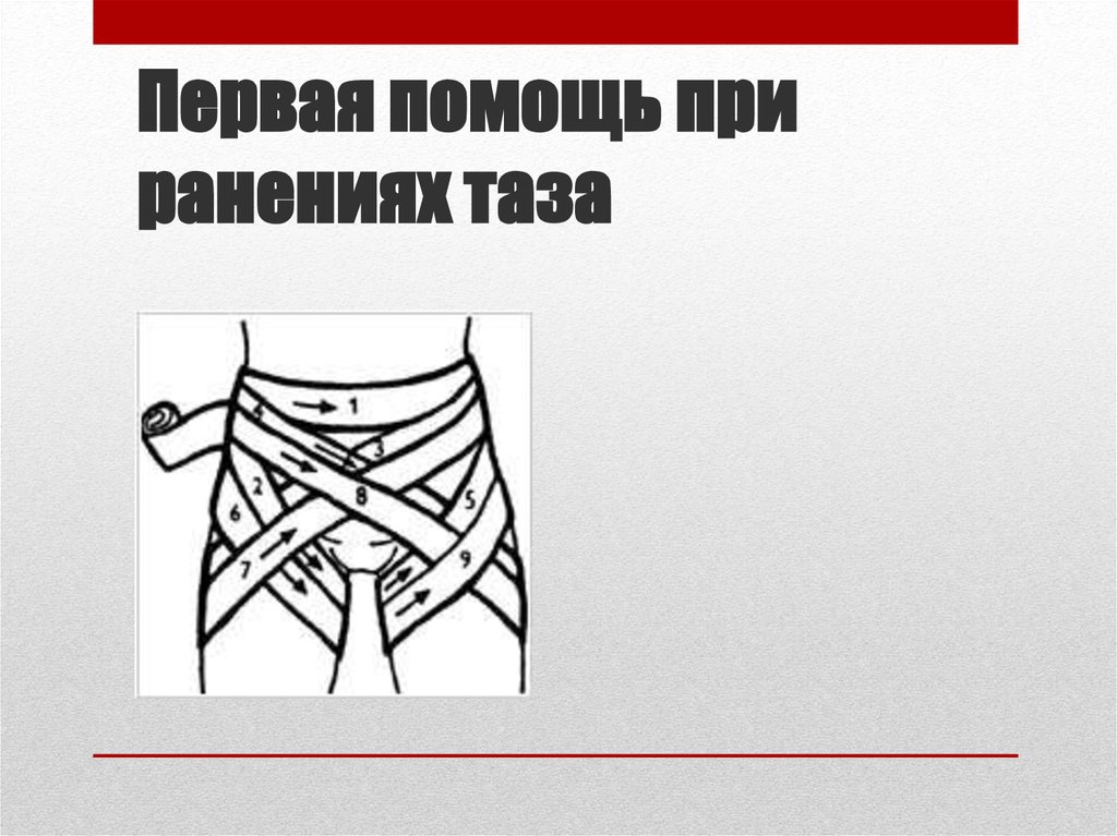Первая помощь при ранениях таза