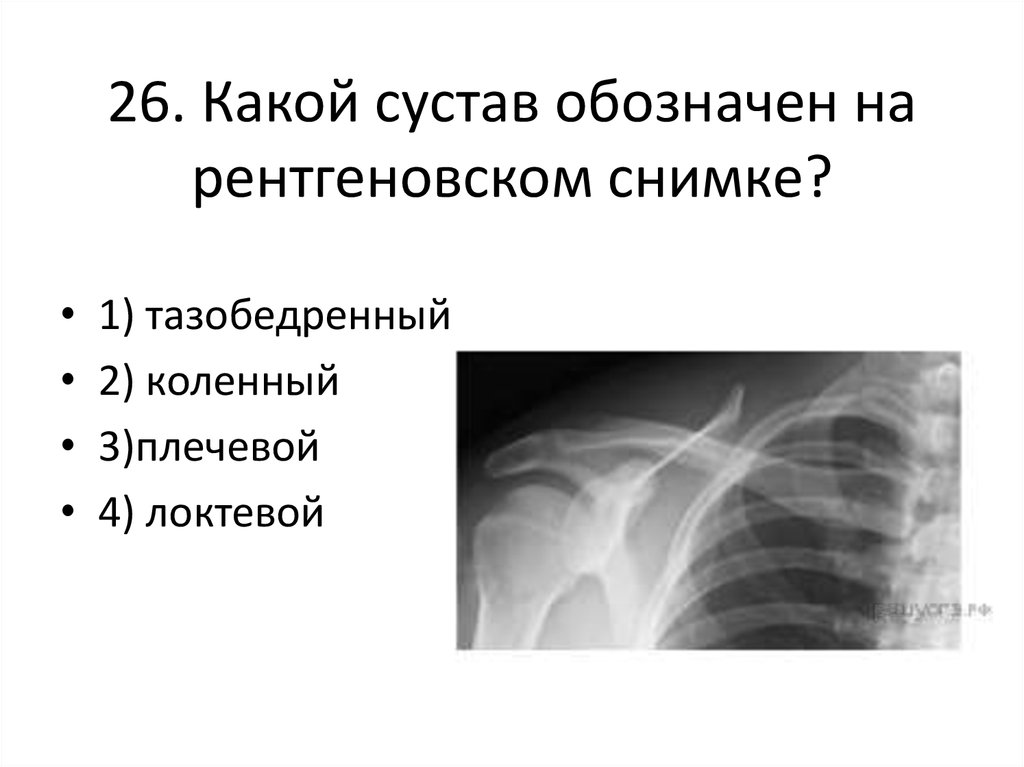 Какой сустав изображен. Какой сустав обозначен на рентгеновском снимке. Обозначения на рентгеновском снимке. Какой сустав изображён на рентгеновских снимках?. Какой сустав обозначен на рентгеновском снимке 1.