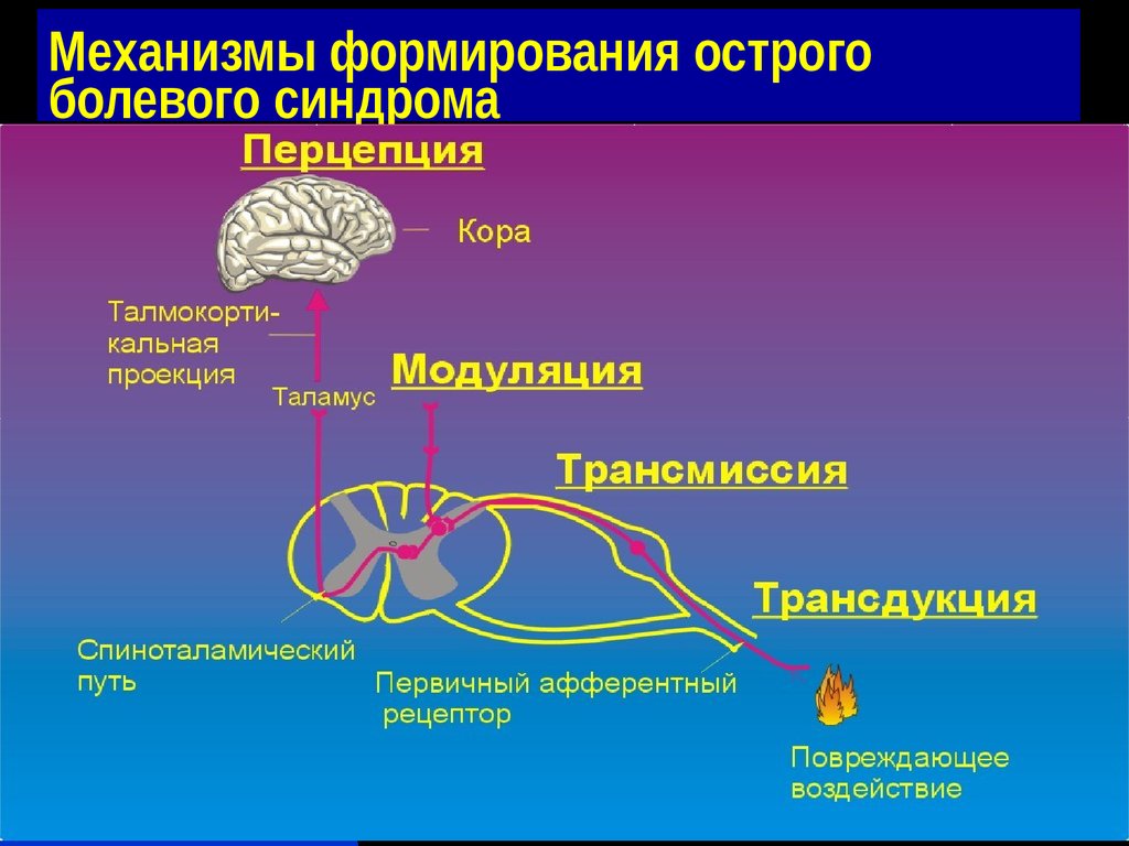 Основные механизмы боли схема