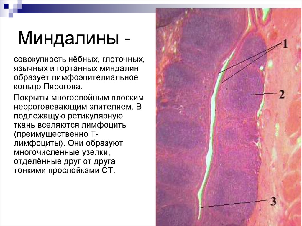 Небная миндалина гистология рисунок