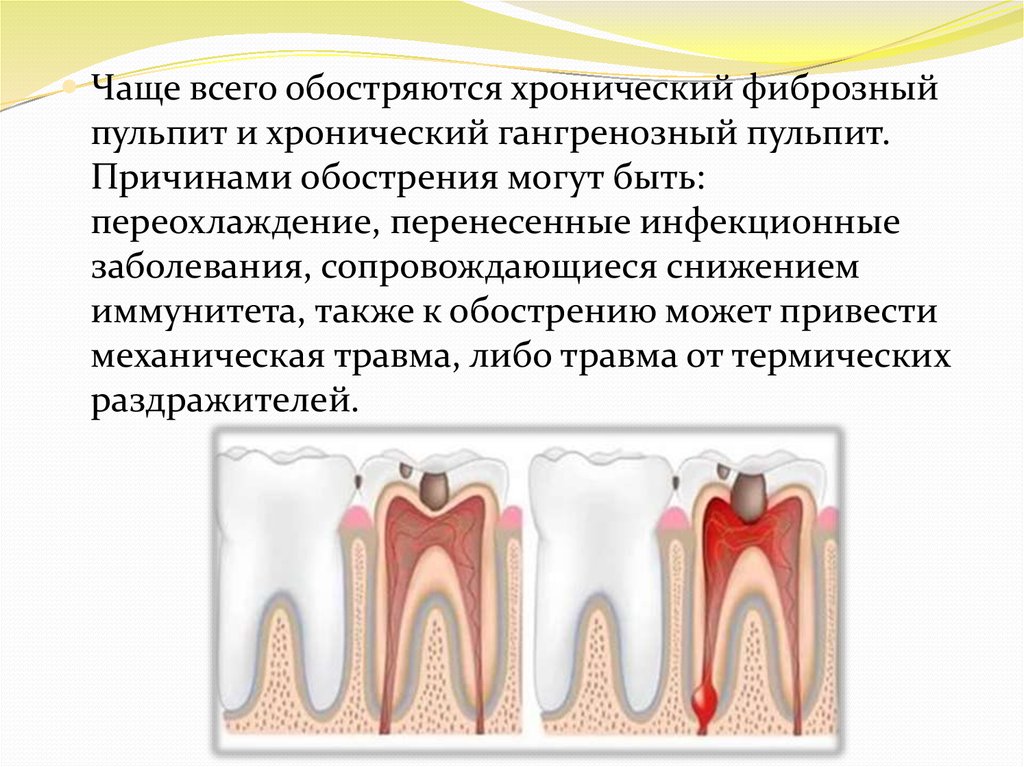 Клиническая картина остаточного пульпита