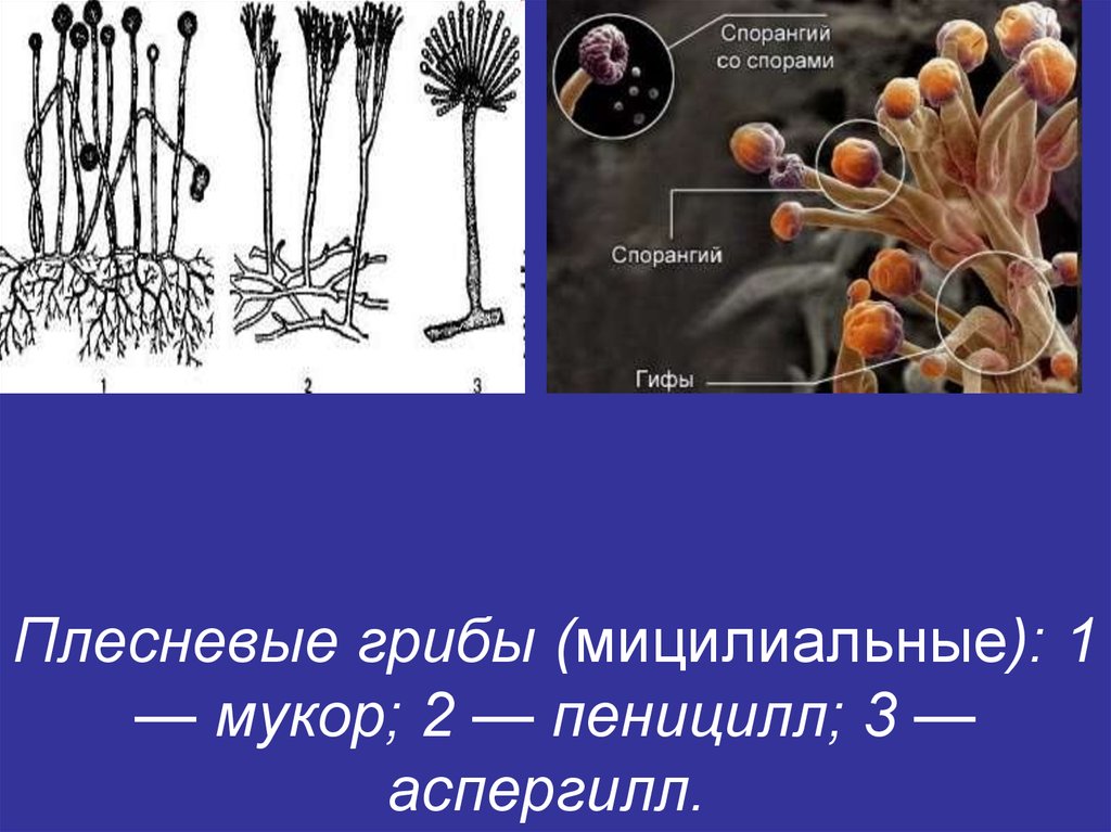 Каково значение мукора в жизни человека. Спорангий аспергилла. Плесневые грибы пеницилл строение. Спорангии плесневого гриба. Плесневые грибы аспергилл.