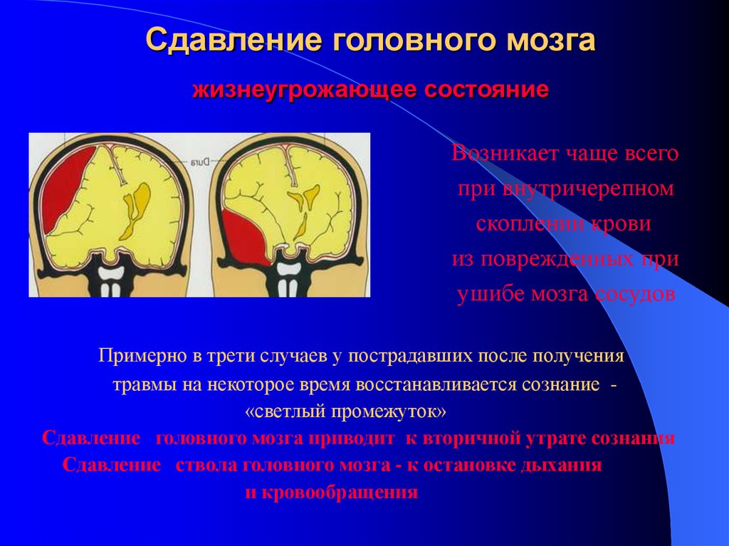 Сотрясение ушиб сдавление головного мозга