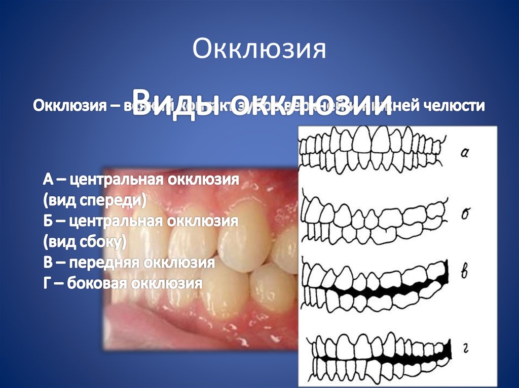 Артикуляция зубов