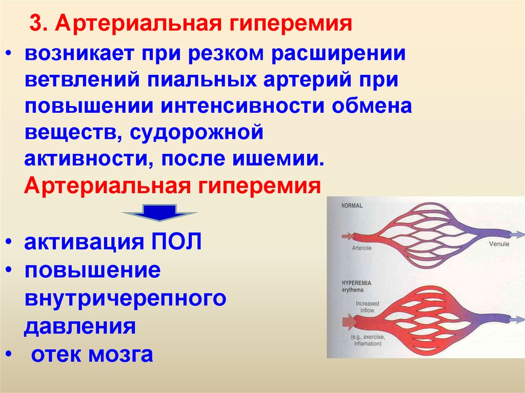 Признаки венозной гиперемии рисунок