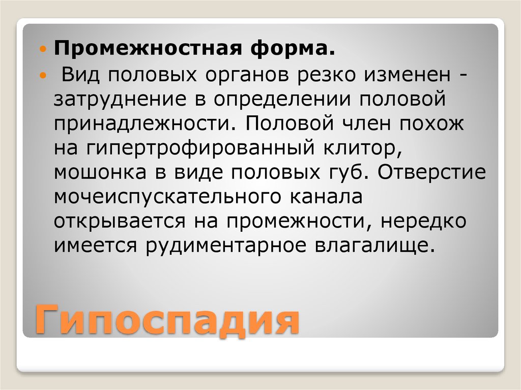 Гипоспадия. Гипоспадия пеноскротальная форма. Установление половой принадлежности.