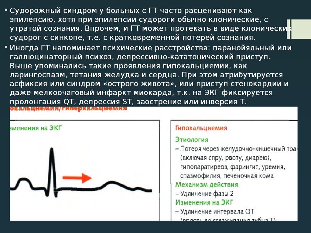 Карта судороги