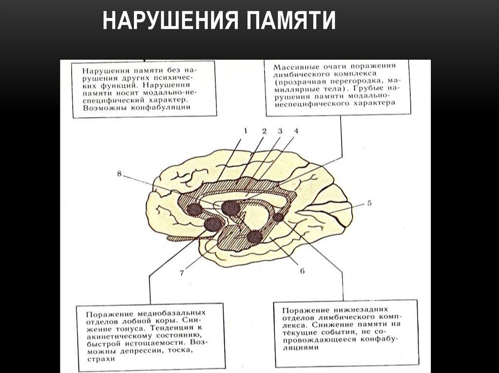 Память в каком отделе мозга. Роль отдельных структур головного мозга в формировании памяти.. Нарушение памяти. Структуры мозга связанные с научением. Локализация памяти в головном мозге.