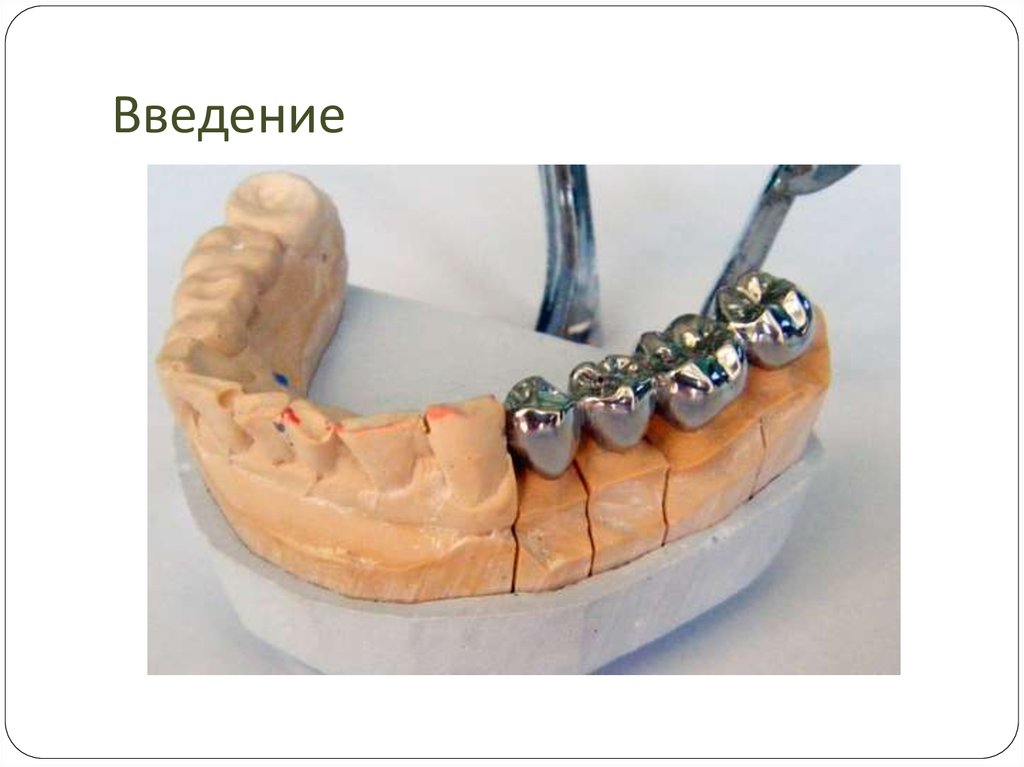 Литейное дело в стоматологии презентация