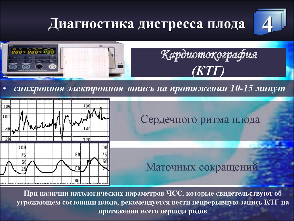 Дистресс плода презентация