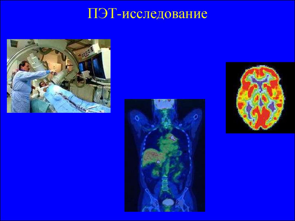 Пэт исследование. Позитронно эмиссионное обследование. Исследование по ПЭТ. Методика ПЭТ исследования.