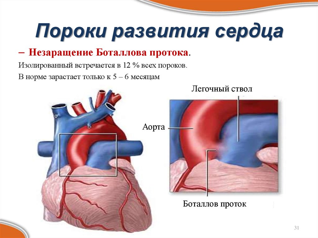 Причины развития пороки сердца