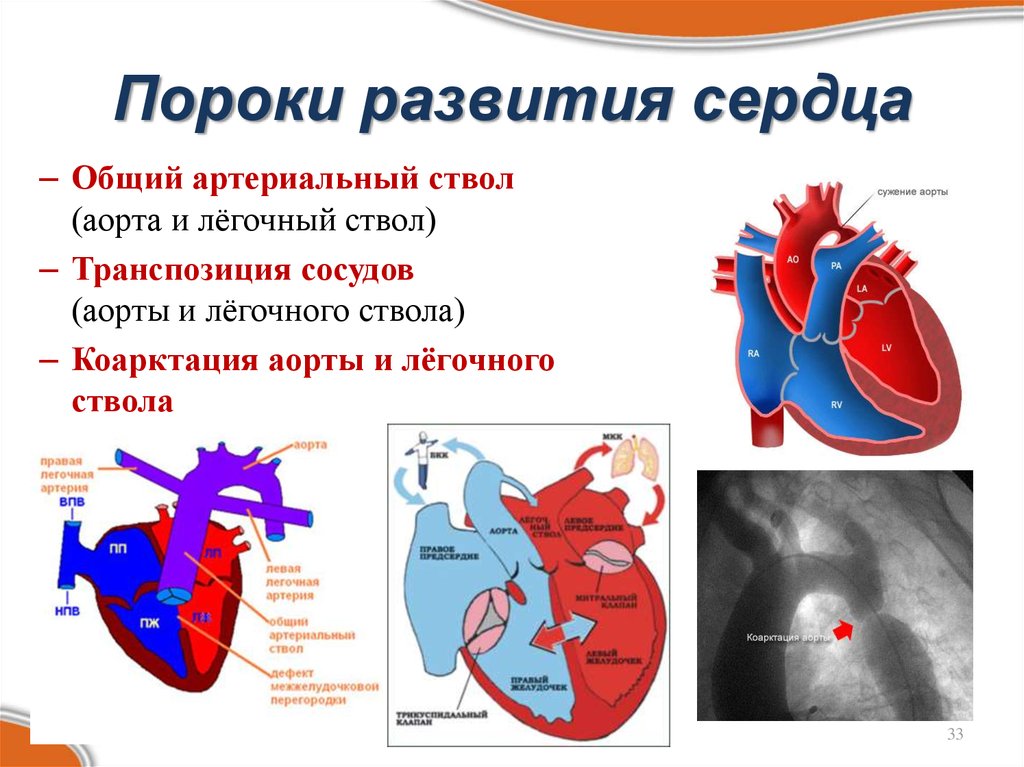 Формирование сердца