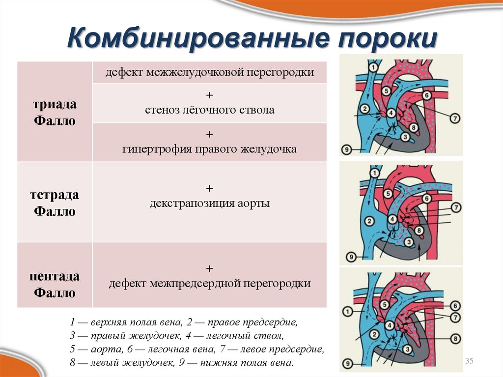 Пороки сердца схема