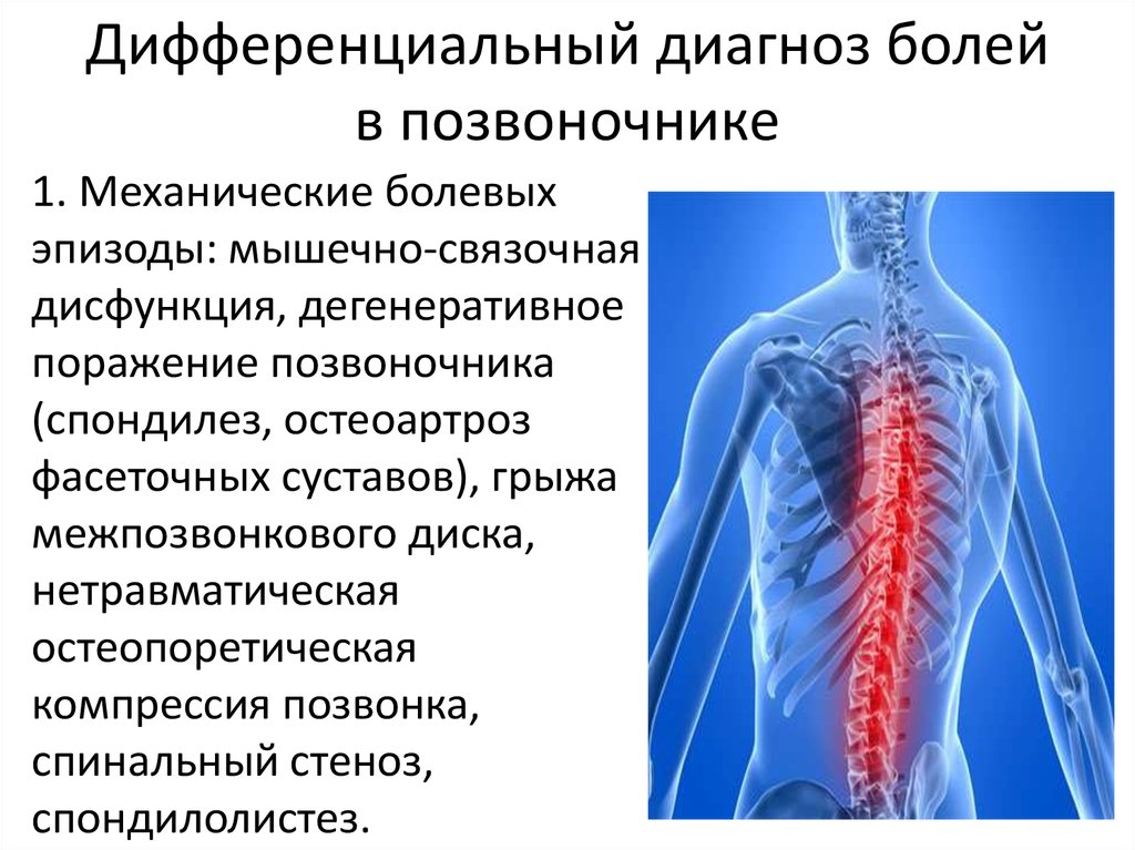 Болит спина без температуры. Дифференциальный диагноз болей в позвоночнике. Диф диагностика болей в спине. Дифференциальная диагностика межпозвоночной грыжи. Дифференциальный диагноз межпозвоночная грыжа.