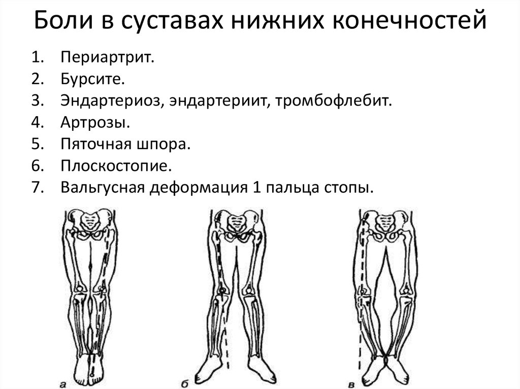 Кости суставы нижних конечностей