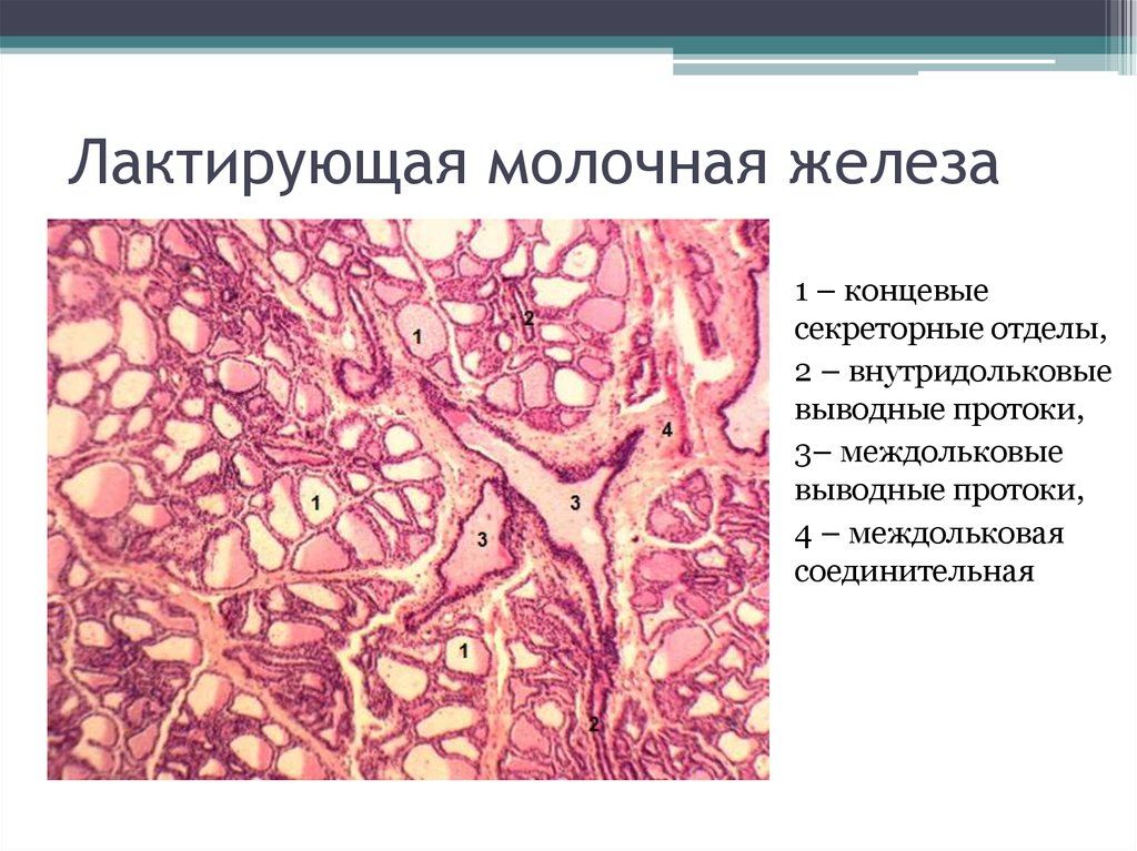 Молочная железа гистология. Лактирующая молочная железа гистология. Лактирующая молочная железа гистология препарат. Строение молочной железы гистология. Молочная железа гистология препарат.