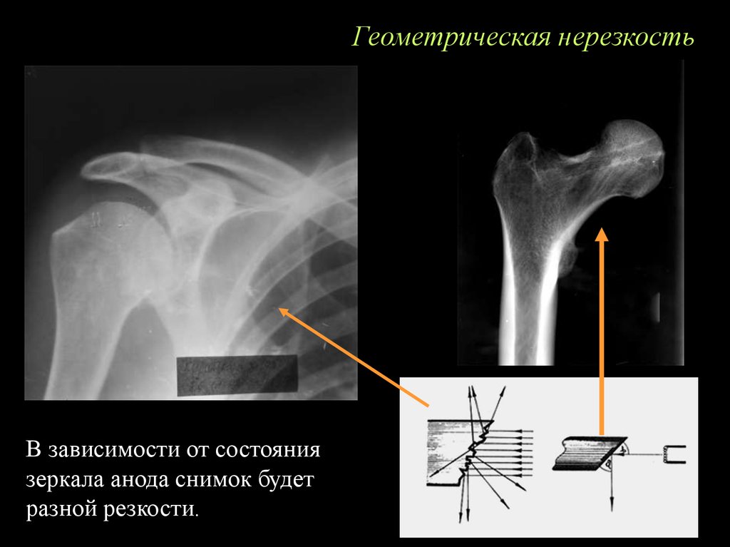 Причины нерезкости изображения