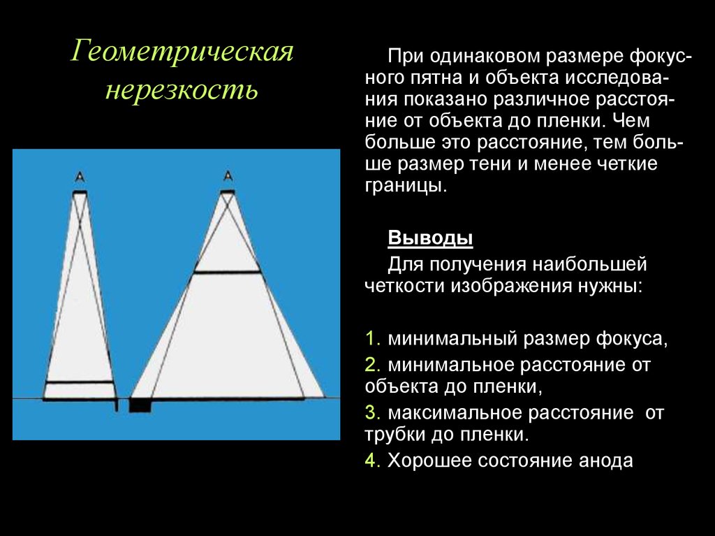 Нерезкость рентгеновского изображения