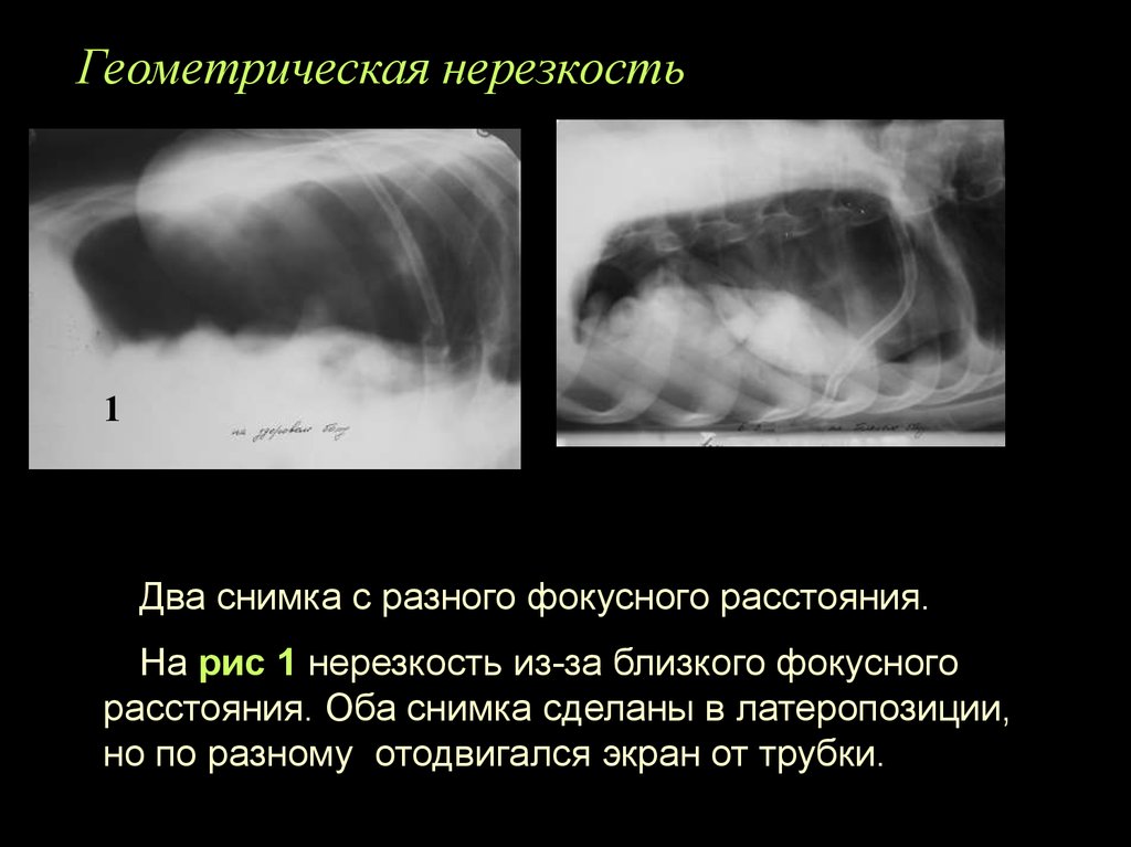 Нерезкость рентгеновского изображения