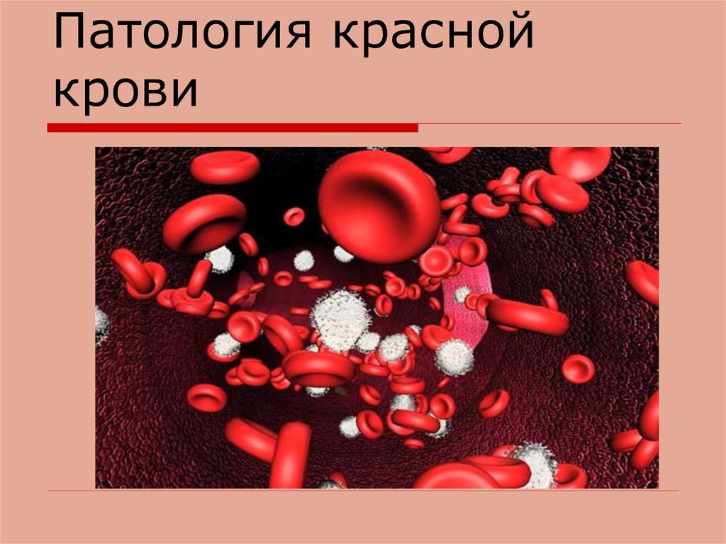 Красная кровь 1