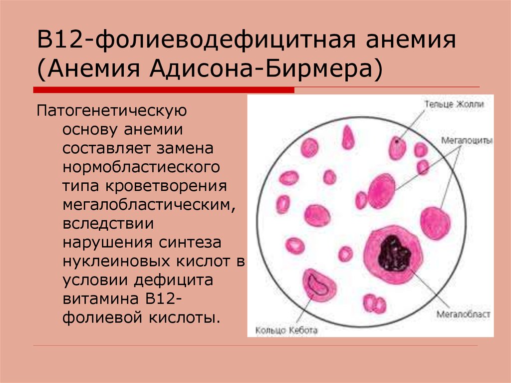 Фолиеводефицитная анемия картинки