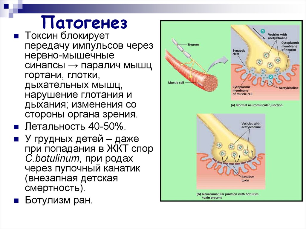 Нарушение мышечного передачи. Ботулотоксин патогенез. Передача нервного импульса через синапс. Что блокирует передачу нервного импульса. Нарушение нервно мышечной передачи.